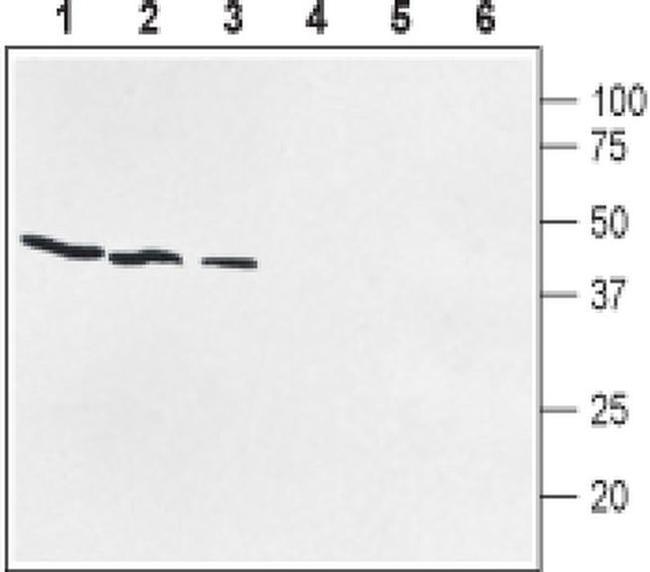 PTGER1 (extracellular) Antibody in Western Blot (WB)