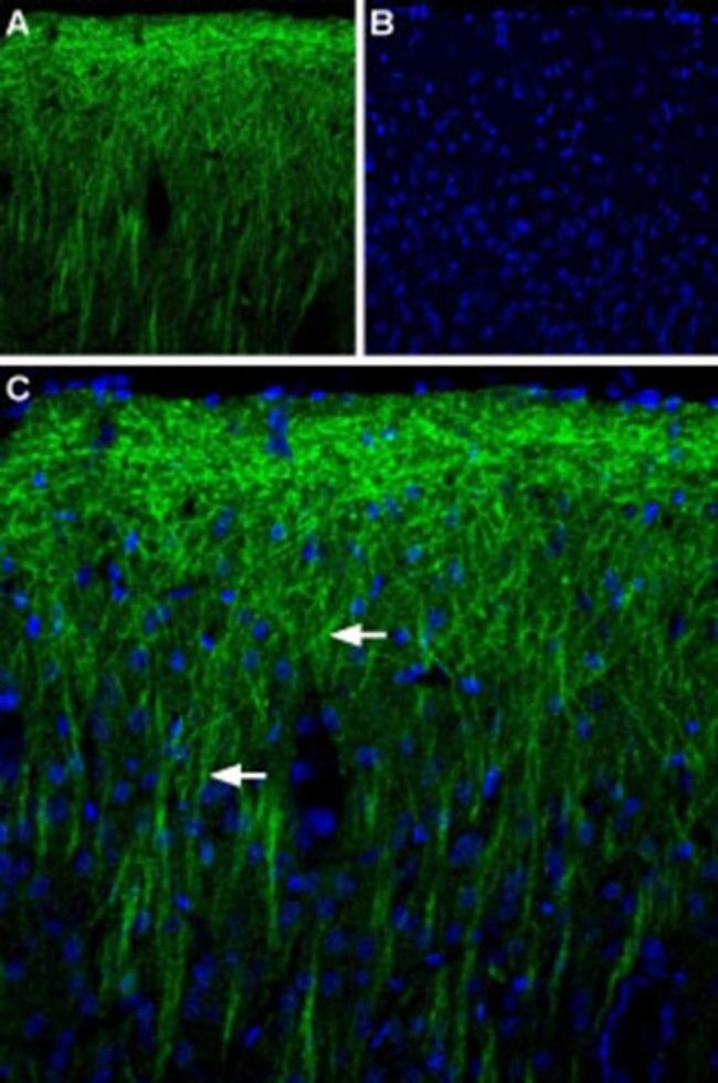 PEX5L Antibody in Immunohistochemistry (IHC)