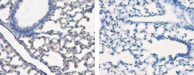 Aquaporin 5 Antibody in Immunohistochemistry (IHC)