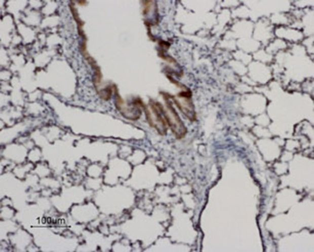 Aquaporin 8 Antibody in Immunohistochemistry (Paraffin) (IHC (P))