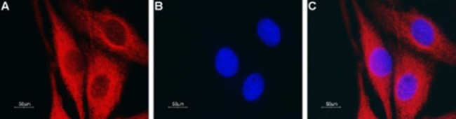 Aquaporin 4 Antibody in Immunocytochemistry (ICC/IF)