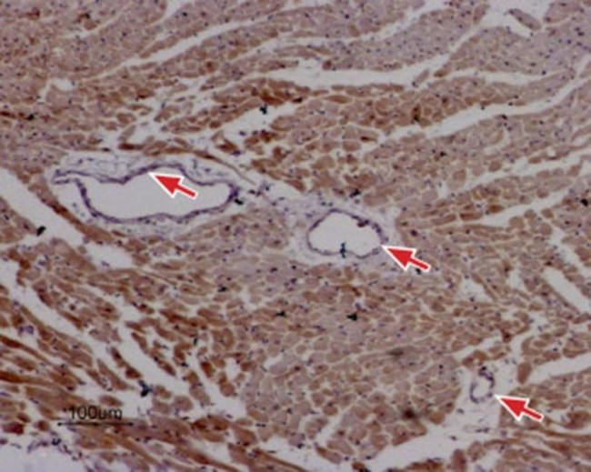 RyR2 Antibody in Immunohistochemistry (Paraffin) (IHC (P))