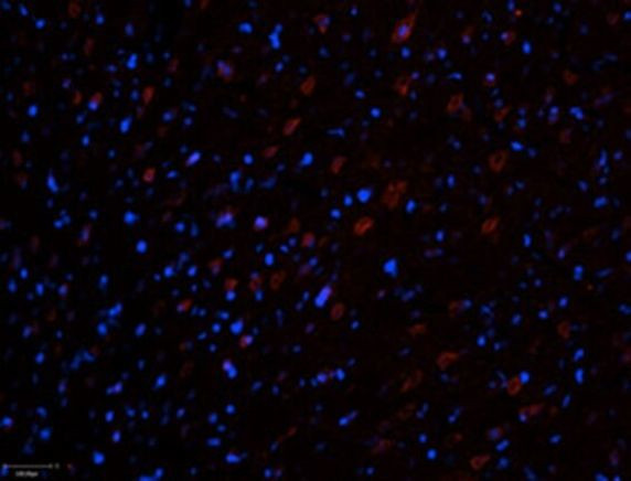 RyR3 Antibody in Immunohistochemistry (Frozen) (IHC (F))