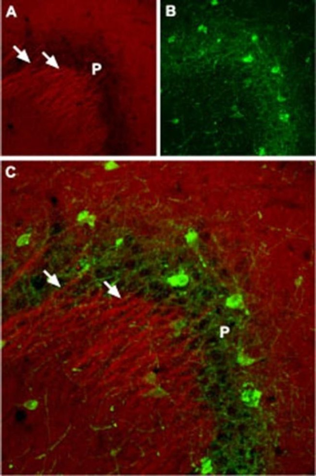 SCN2A Antibody in Immunohistochemistry (IHC)