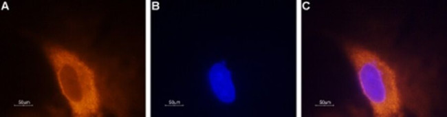 SCN3A Antibody in Immunocytochemistry (ICC/IF)