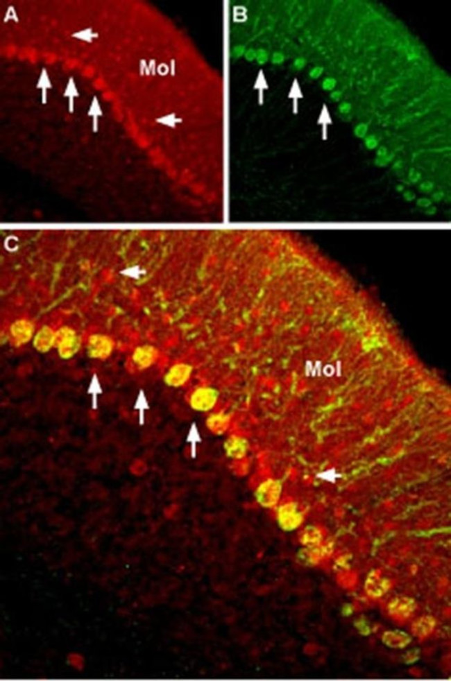 SCN2B Antibody in Immunohistochemistry (IHC)