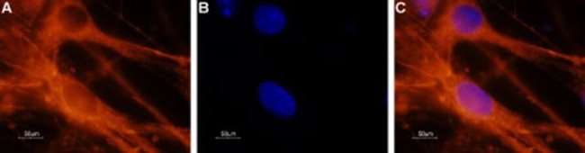 SCN8A Antibody in Immunocytochemistry (ICC/IF)
