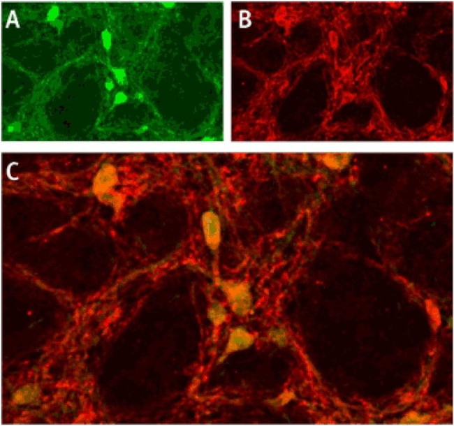 ASIC1 Antibody in Immunohistochemistry (IHC)