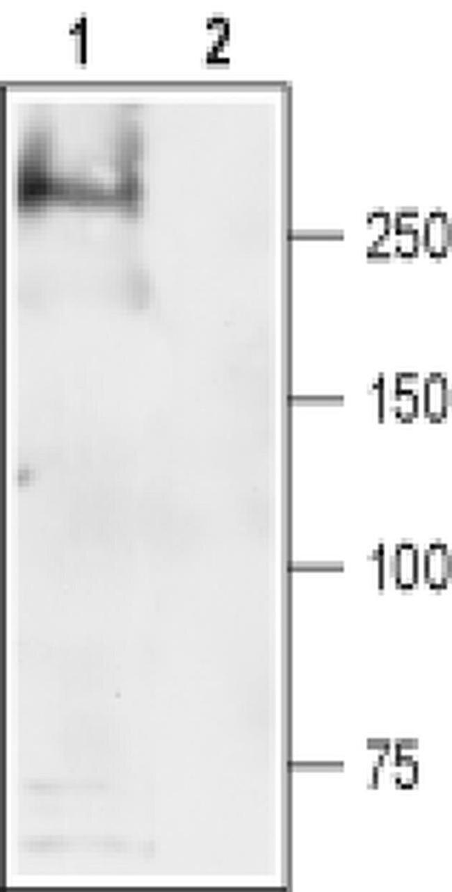 SCN4A Antibody in Western Blot (WB)