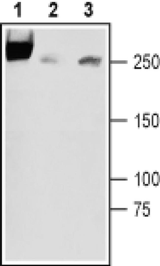 SCN3A (extracellular) Antibody in Western Blot (WB)