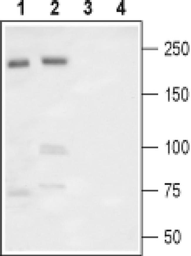 SCN9A (extracellular) Antibody in Western Blot (WB)