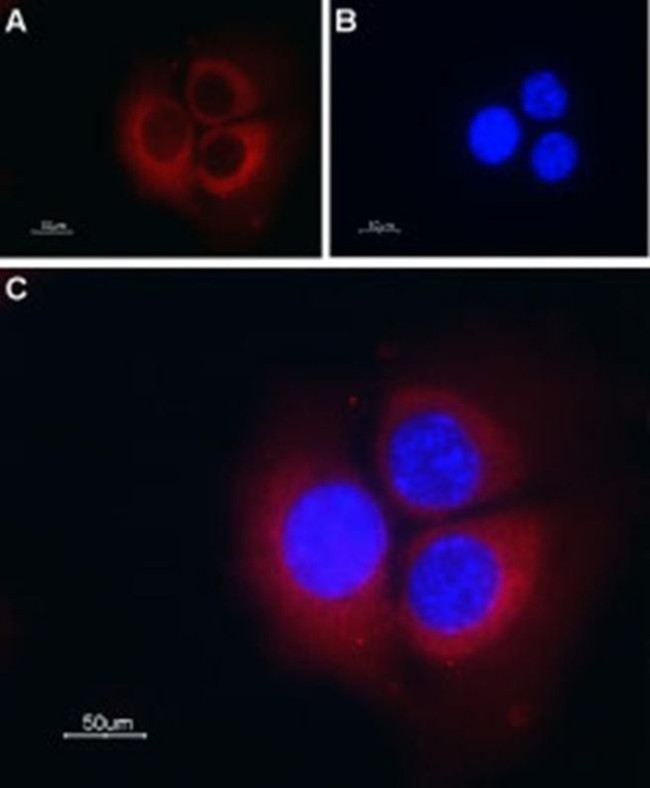 TMEM38B Antibody in Immunocytochemistry (ICC/IF)
