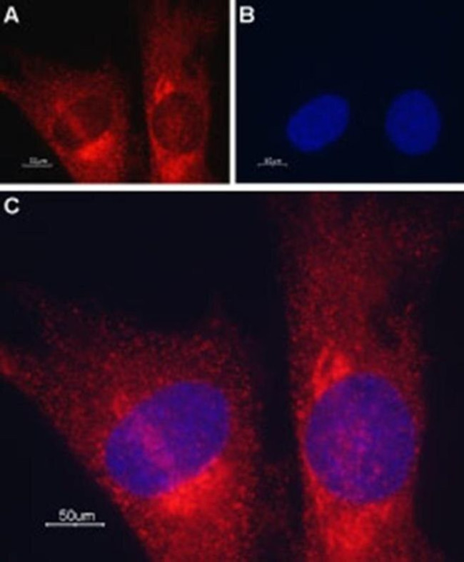 TMEM38A Antibody in Immunocytochemistry (ICC/IF)