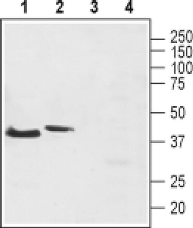 TACR2 Antibody in Western Blot (WB)
