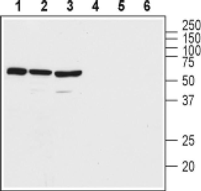 VPAC2 (extracellular) Antibody in Western Blot (WB)