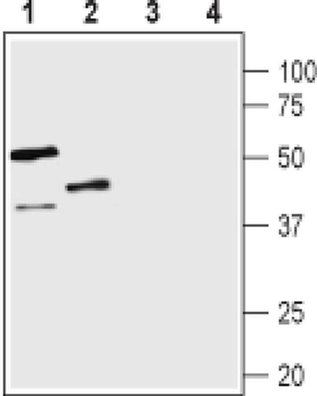 AVPR1B Antibody in Western Blot (WB)