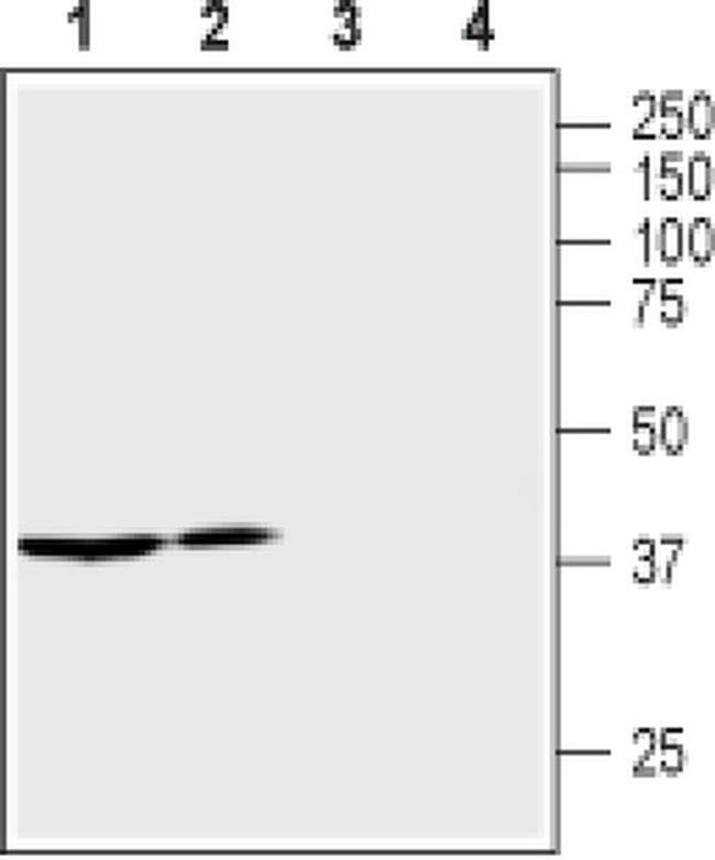 AVPR2 Antibody in Western Blot (WB)