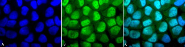 Methylated Lysine Antibody in Immunocytochemistry (ICC/IF)