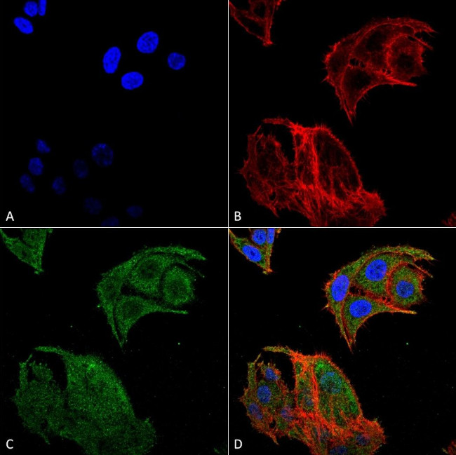 IRGM Antibody in Immunocytochemistry (ICC/IF)