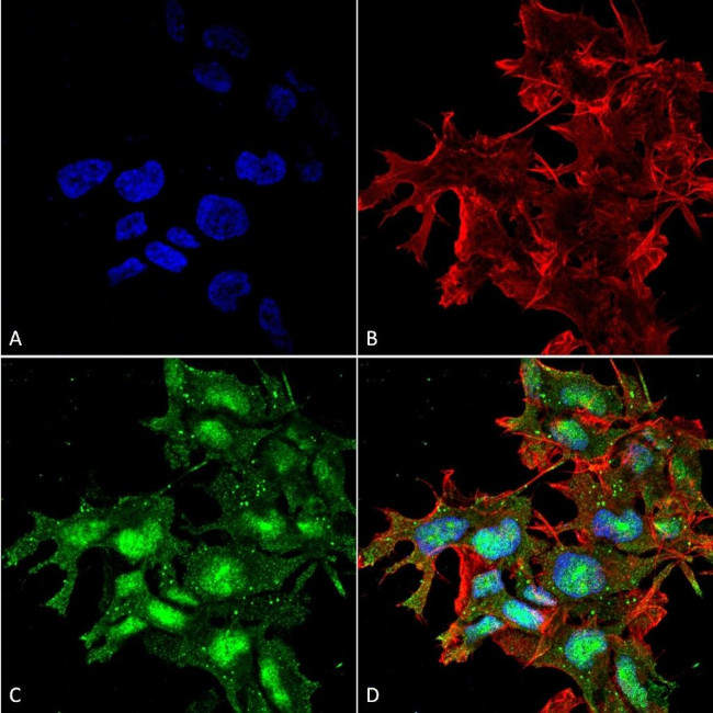 ATG2A Antibody in Immunocytochemistry (ICC/IF)