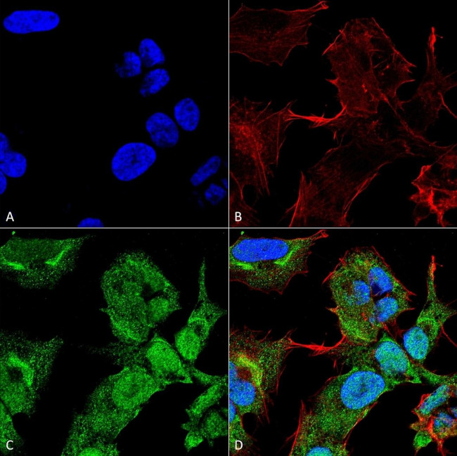 GABARAPL2 Antibody in Immunocytochemistry (ICC/IF)