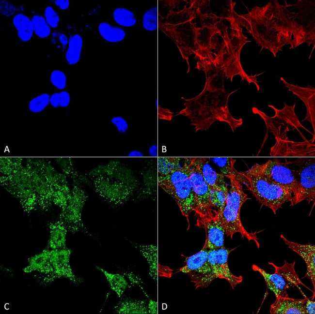 FIP200 Antibody in Immunocytochemistry (ICC/IF)