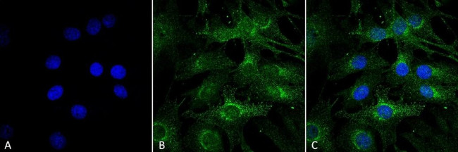 ATG13 Antibody in Immunocytochemistry (ICC/IF)