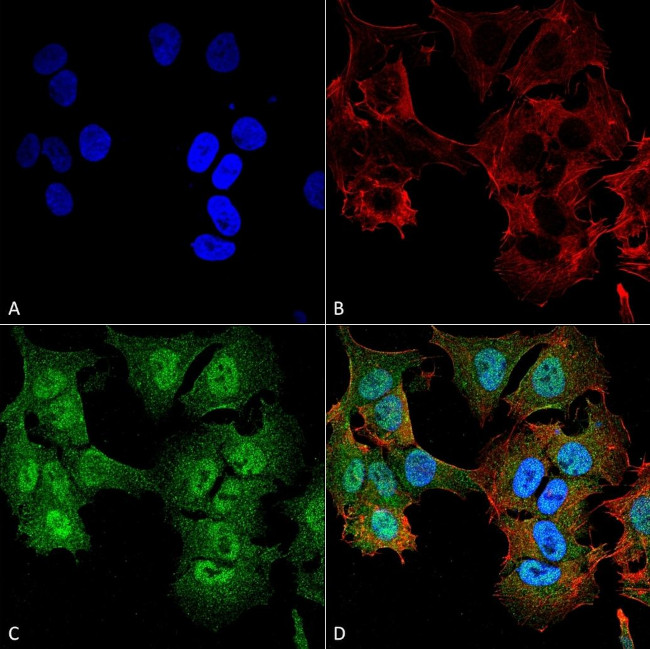 ULK2 Antibody in Immunocytochemistry (ICC/IF)