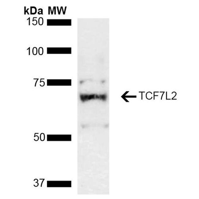 TCF7L2 Antibody in Western Blot (WB)