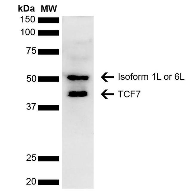 TCF7 Antibody in Western Blot (WB)