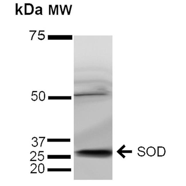 SOD3 Antibody in Western Blot (WB)