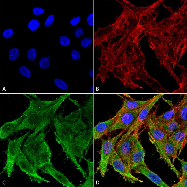 Kir4.1 (KCNJ10) Antibody in Immunocytochemistry (ICC/IF)