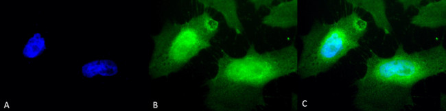 HSPB2 Antibody in Immunocytochemistry (ICC/IF)