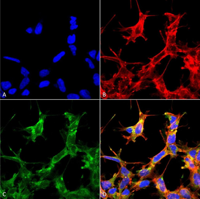 Acetyl-HSP70 (Lys77) Antibody in Immunocytochemistry (ICC/IF)