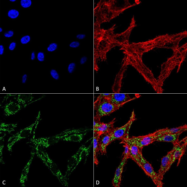 HSF2 Antibody in Immunocytochemistry (ICC/IF)