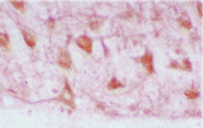 Heme oxygenase 2 Antibody in Immunohistochemistry (IHC)