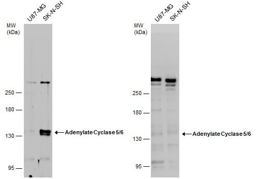 Adenylate Cyclase 5/6 Antibody in Western Blot (WB)