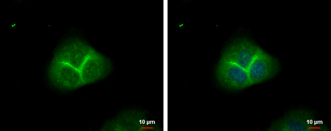 alpha Adducin Antibody in Immunocytochemistry (ICC/IF)