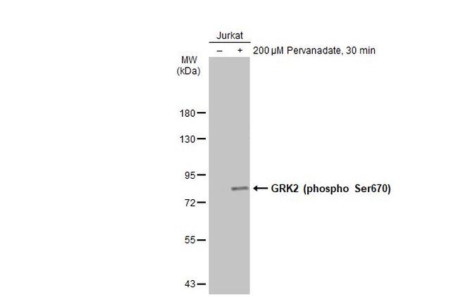 Phospho-GRK2 (Ser670) Antibody in Western Blot (WB)