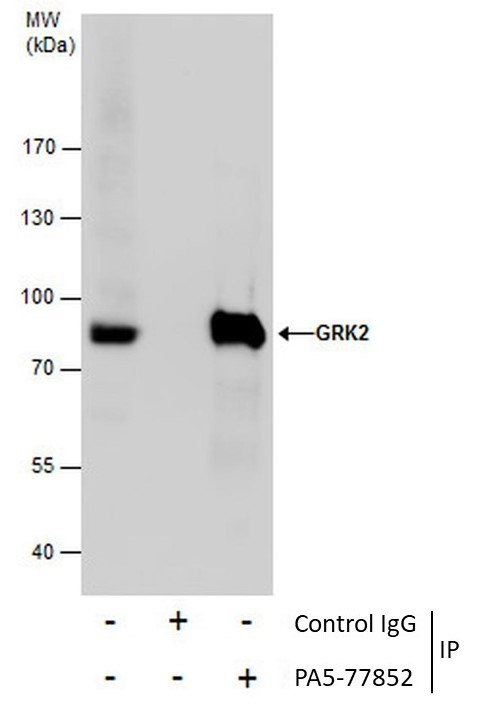 GRK2 Antibody in Immunoprecipitation (IP)