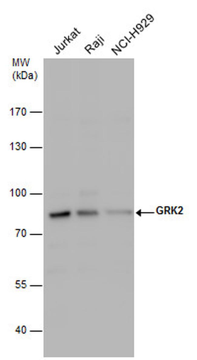 GRK2 Antibody in Western Blot (WB)