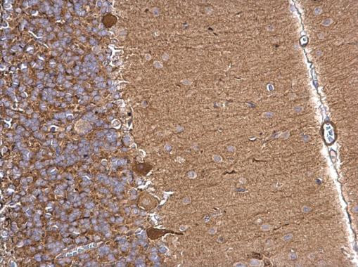 Aldolase A Antibody in Immunohistochemistry (Paraffin) (IHC (P))