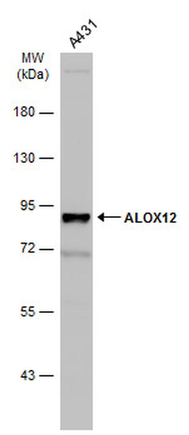 ALOX12 Antibody in Western Blot (WB)
