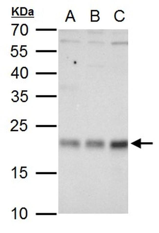 RhoA Antibody in Western Blot (WB)