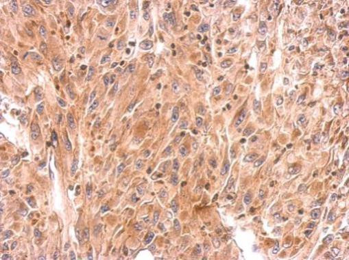 RhoB Antibody in Immunohistochemistry (Paraffin) (IHC (P))
