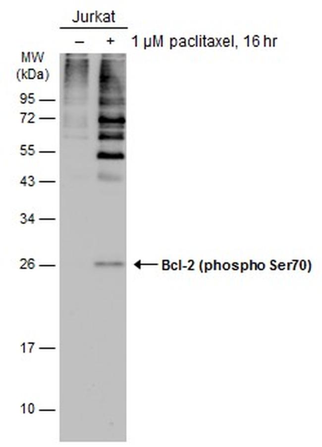 Phospho-Bcl-2 (Ser70) Antibody in Western Blot (WB)