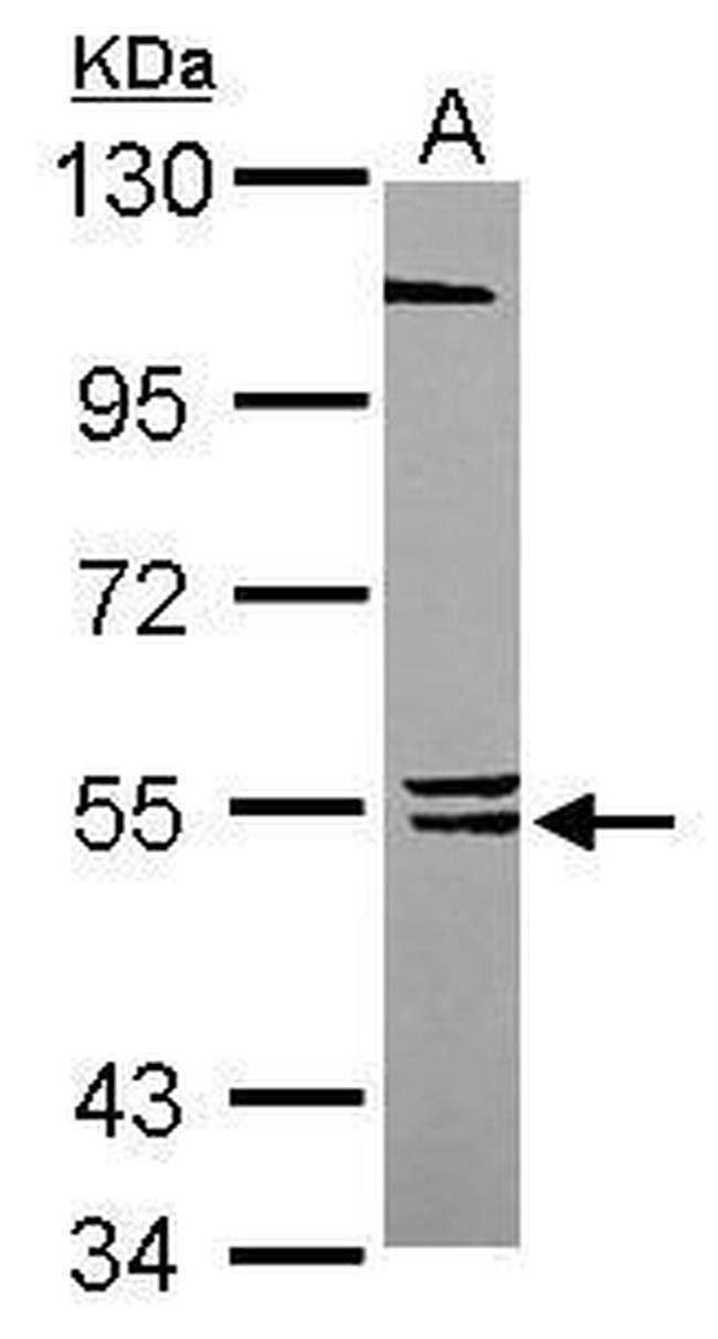 BLK Antibody in Western Blot (WB)