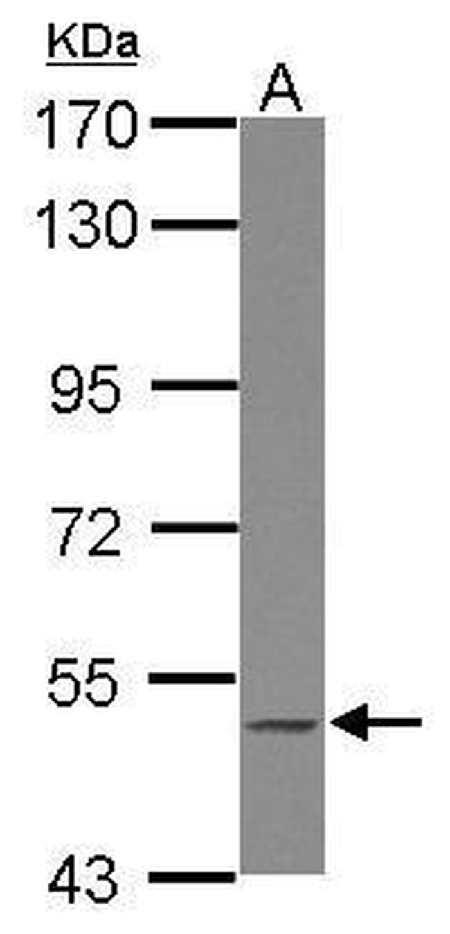 BLK Antibody in Western Blot (WB)