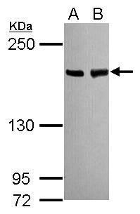 Blooms Syndrome Antibody in Western Blot (WB)
