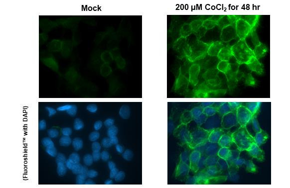 Carbonic Anhydrase IX Antibody in Immunocytochemistry (ICC/IF)